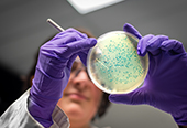 Medical researcher examining a bacterial culture plate.